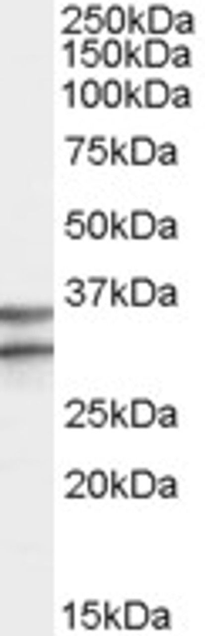 45-521 (3.8ug/ml) staining of paraffin embedded Human Colon. Steamed antigen retrieval with citrate buffer pH 6, AP-staining. <strong>This data is from a previous batch, not on sale.</strong>