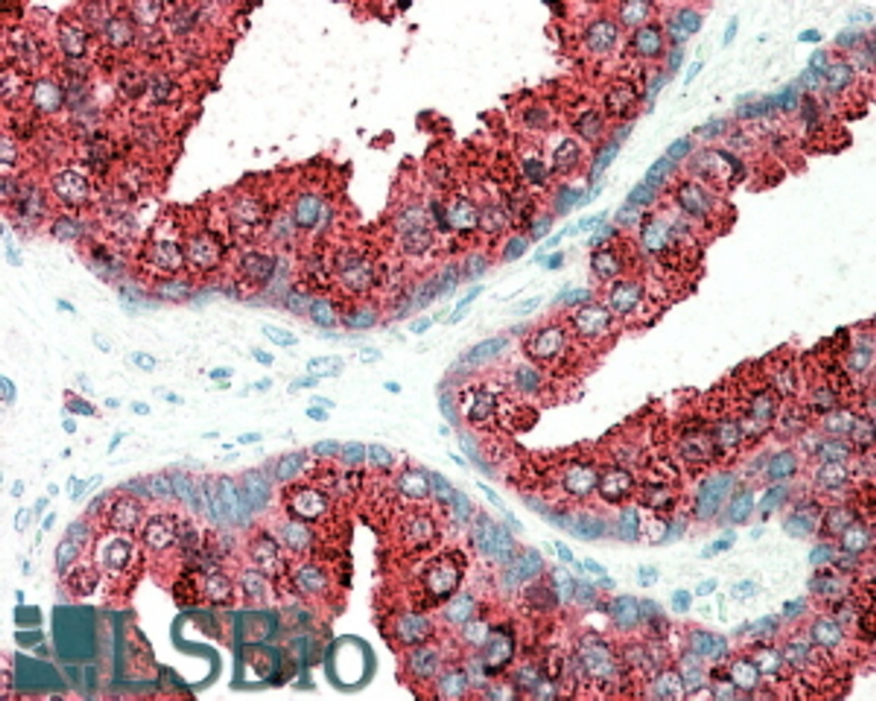 45-532 (5ug/ml) staining of paraffin embedded Human Prostate. Steamed antigen retrieval with citrate buffer pH 6, AP-staining.
