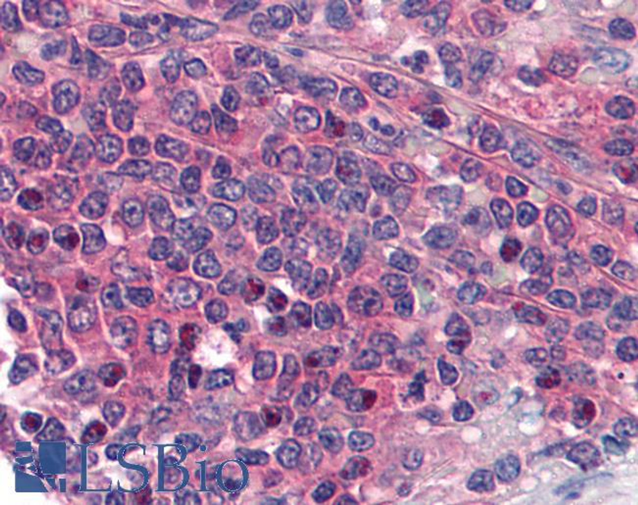 45-539 (2ug/ml) staining of paraffin embedded Human Kidney. Steamed antigen retrieval with citrate buffer pH 6, HRP-staining.
