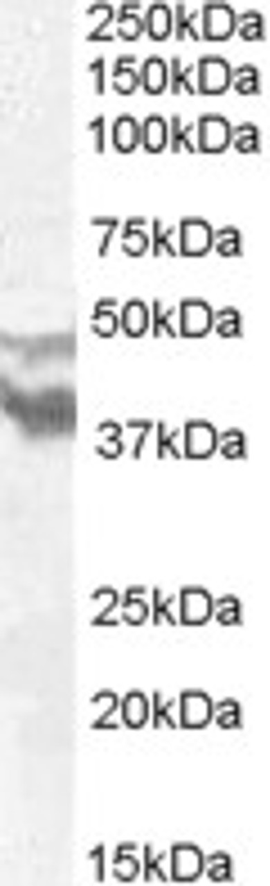 45-557 (0.5ug/ml) staining of Human Lung lysate (35ug protein in RIPA buffer) . Primary incubation was 1 hour. Detected by chemiluminescence.