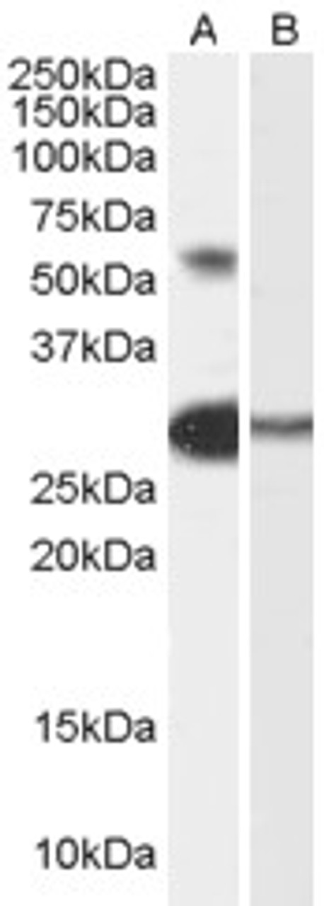 45-562 (0.5ug/ml) staining of Human Skin lysate (35ug protein in RIPA buffer) . Primary incubation was 1 hour. Detected by chemiluminescence.