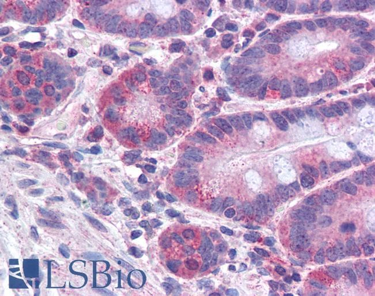 45-563 (3.75ug/ml) staining of paraffin embedded Human Small Intestine. Steamed antigen retrieval with citrate buffer pH 6, AP-staining.