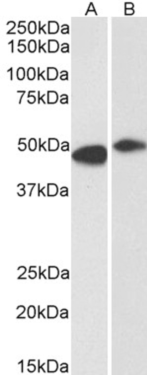 45-571 (0.3ug/ml) staining of Human Frontal Cortex (A) and Rat (B) Brain lysate (35ug protein in RIPA buffer) . Detected by chemiluminescence