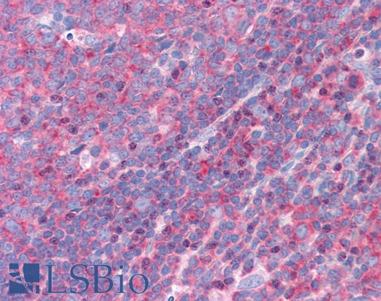 45-572 (3.75ug/ml) staining of paraffin embedded Human Tonsil. Steamed antigen retrieval with citrate buffer pH 6, AP-staining.