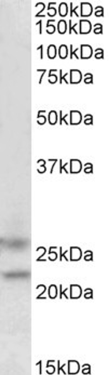 45-581 (1.5ug/ml) staining of Human Brain (cerebellum) lysate (35ug protein in RIPA buffer) . Detected by chemiluminescence.