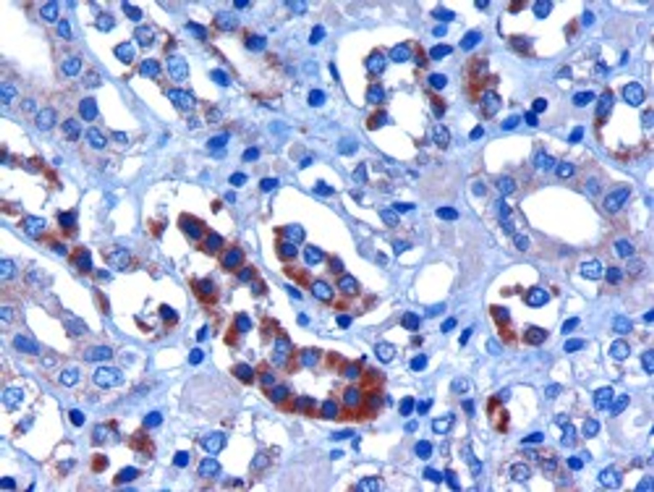 45-583 (3ug/ml) staining of paraffin embedded Human Kidney. Microwaved antigen retrieval with citrate buffer pH 6, HRP-staining.