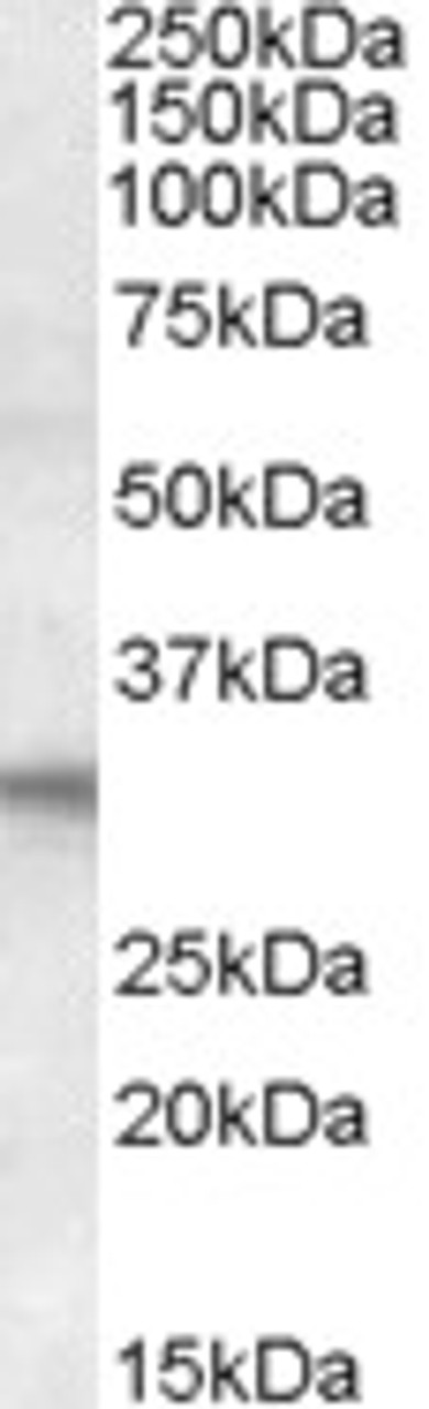 45-592 (1ug/ml) staining of Human Heart lysate (35ug protein in RIPA buffer) . Primary incubation was 1 hour. Detected by chemiluminescence.