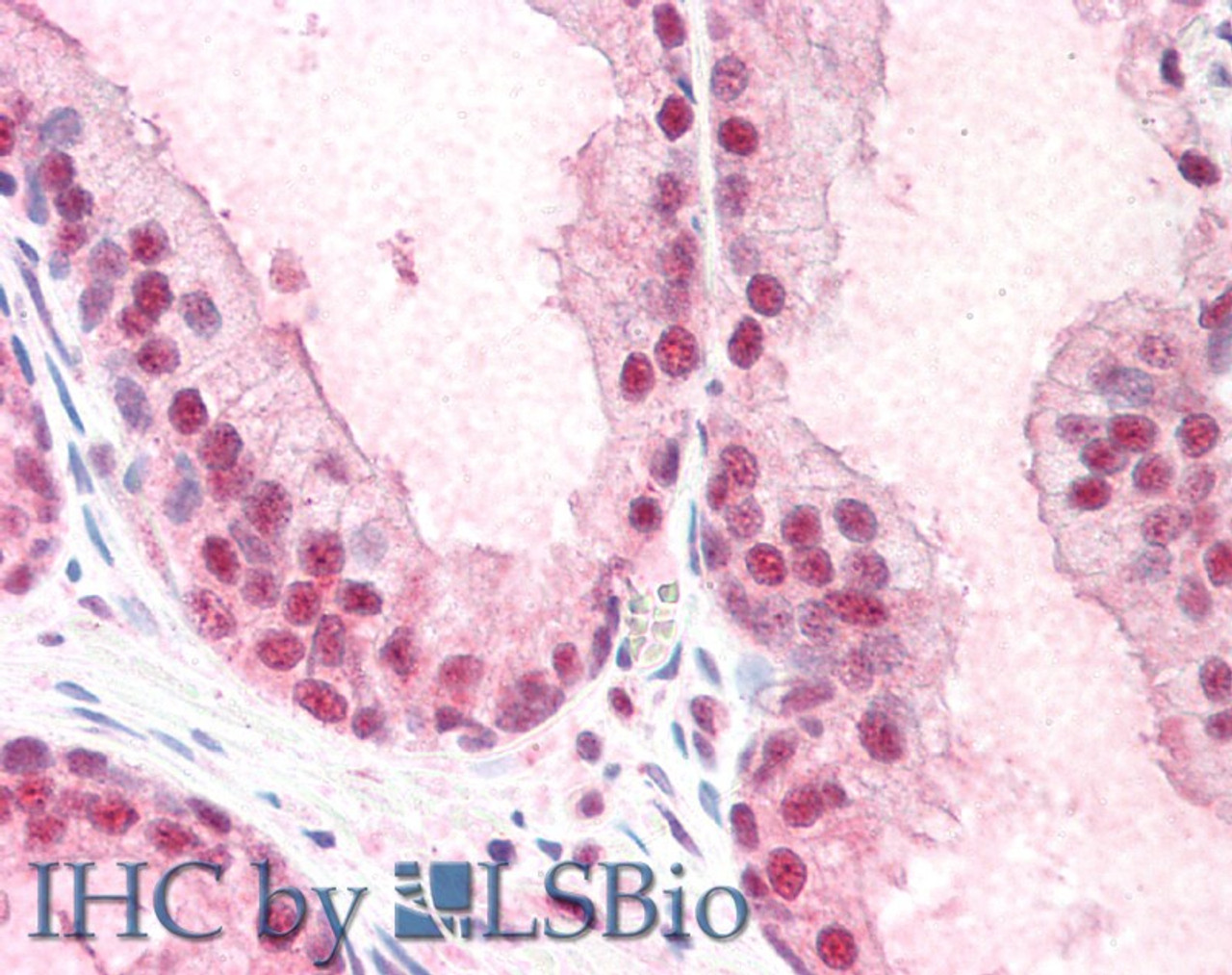 45-596 (5ug/ml) staining of paraffin embedded Human Prostate. Steamed antigen retrieval with citrate buffer pH 6, AP-staining.