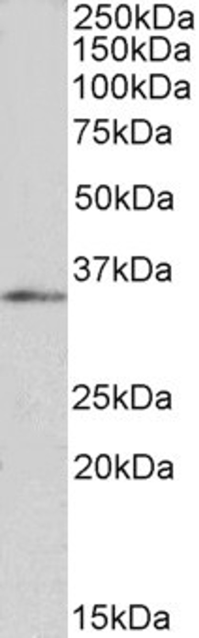 45-602 (1ug/ml) staining of HepG2 nuclear lysate (35ug protein in RIPA buffer) . Primary incubation was 1 hour. Detected by chemiluminescence