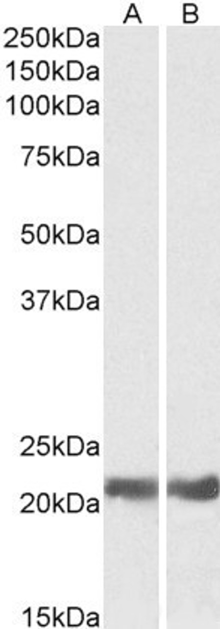 45-541 (0.1ug/ml) staining of Human Brain (Cerebellum) lysate (35ug protein in RIPA buffer) with (B) and without (A) blocking with the immunising peptide. Primary incubation was 1 hour. Detected by chemiluminescence.