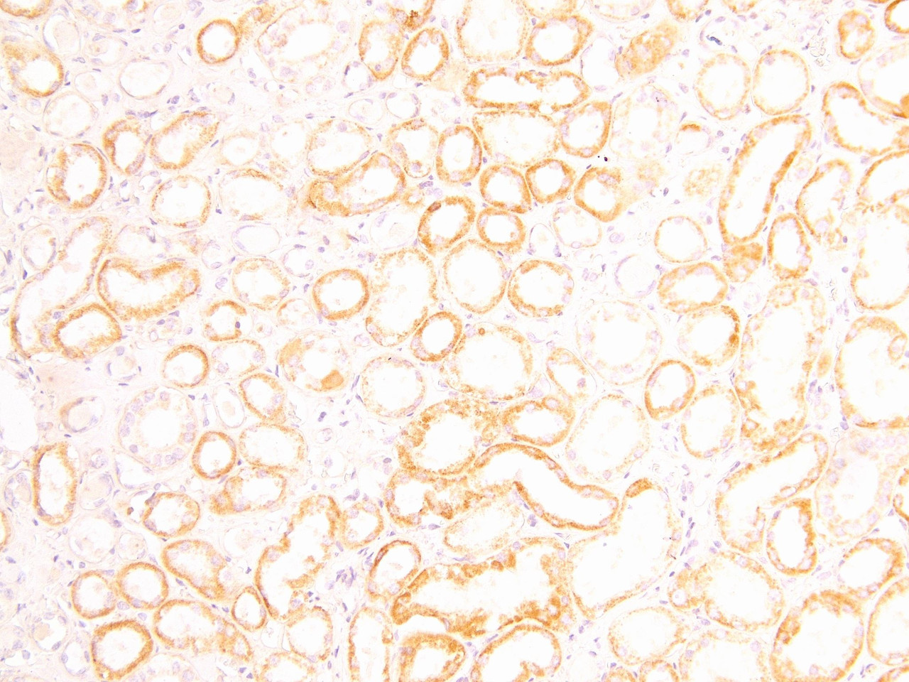 45-606 (3.75ug/ml) staining of paraffin embedded Human Kidney. Heat induced antigen retrieval with citrate buffer pH 6, HRP-staining.