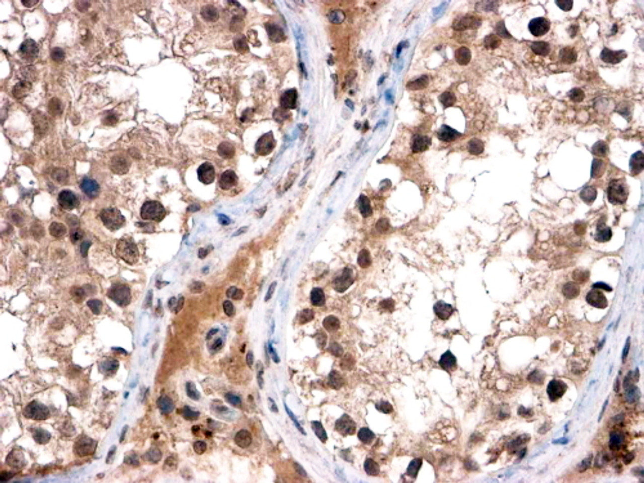 45-613 (2ug/ml) staining of paraffin embedded Human Testis. Steamed antigen retrieval with citrate buffer pH 6, HRP-staining. <strong>This data is from a previous batch, not on sale.</strong>