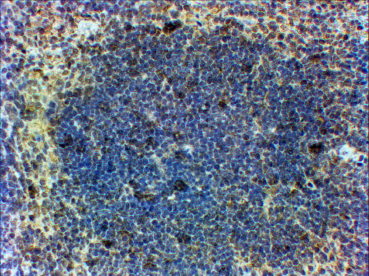 In paraffin embedded Mouse Spleen shows patches of stained cells in the Germinal Centre. Recommended concentration, 2-4ug/ml.