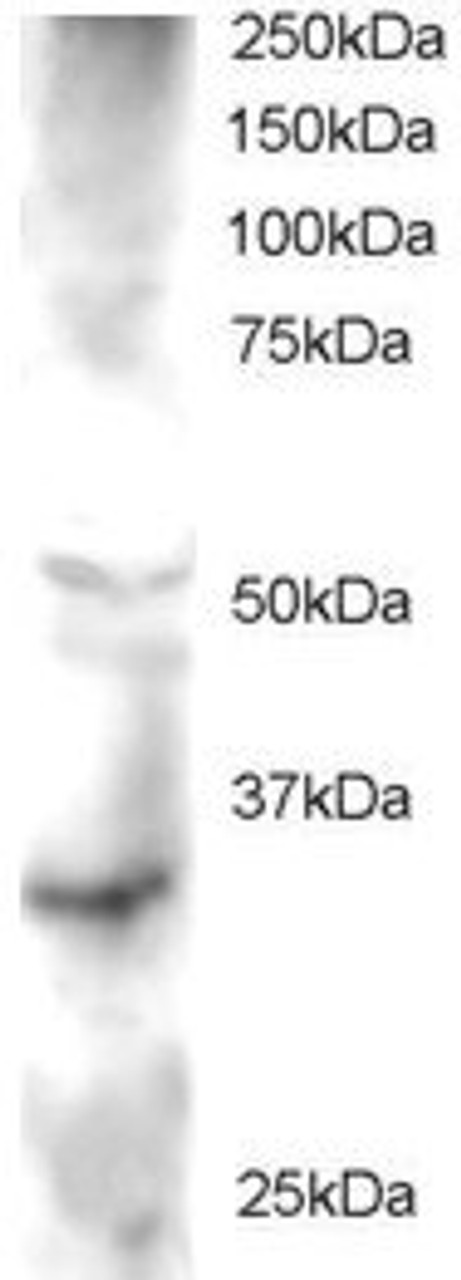 45-633 staining (2ug/ml) of Human Heart lysate (RIPA buffer, 30ug total protein per lane) . Primary incubated for 1 hour. Detected by western blot using chemiluminescence.