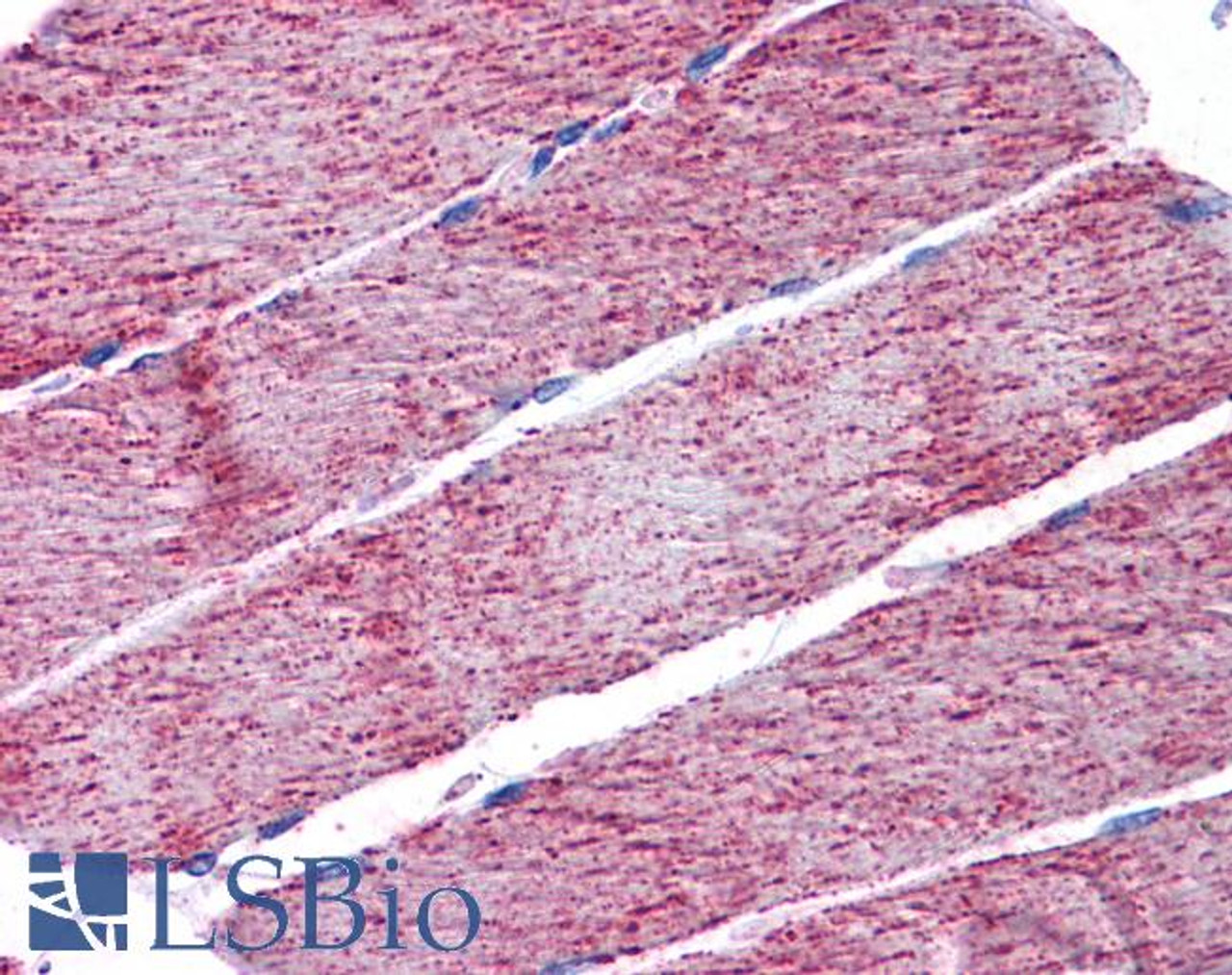 HEK293 overexpressing Fumarase and probed with 45-641 (mock transfection in first lane) .