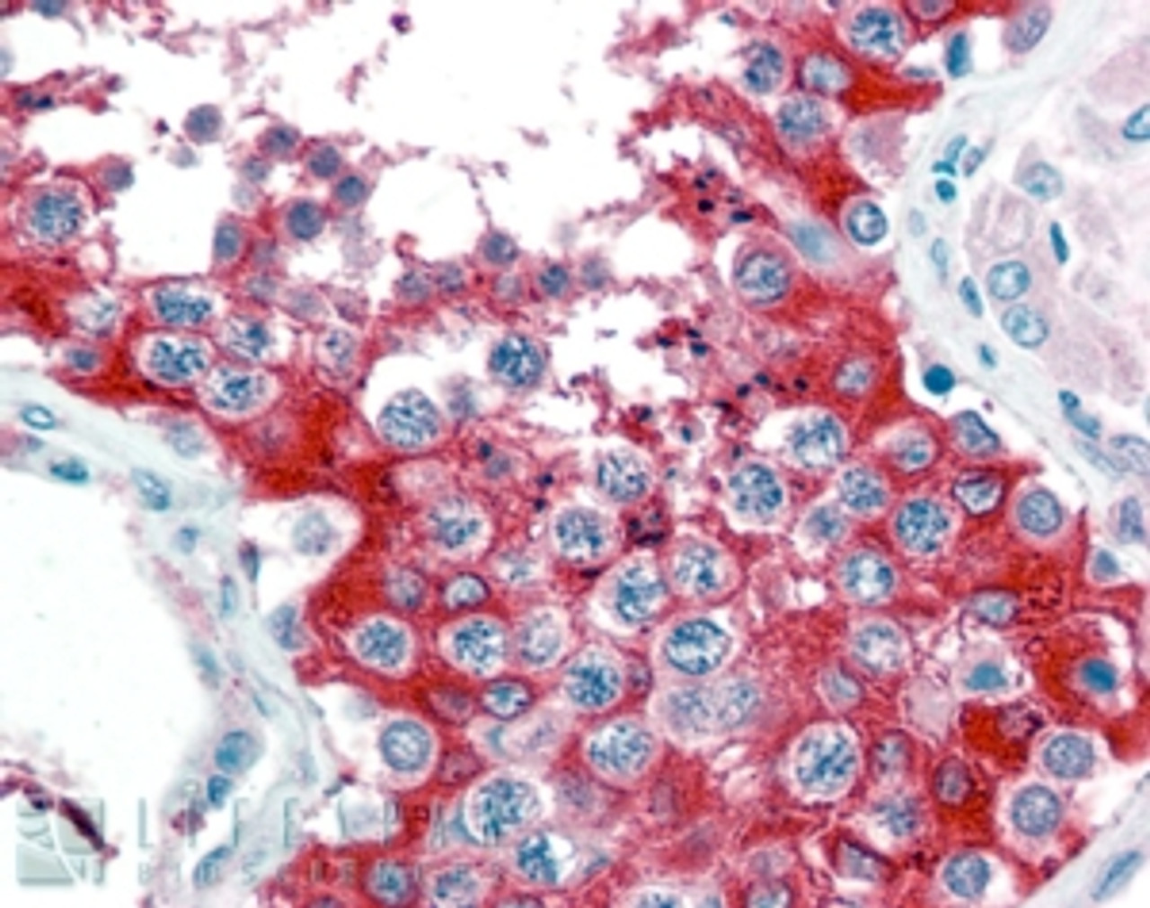 45-644 (0.03ug/ml) staining of Human Testis lysate (35ug protein in RIPA buffer) . Detected by chemiluminescence.