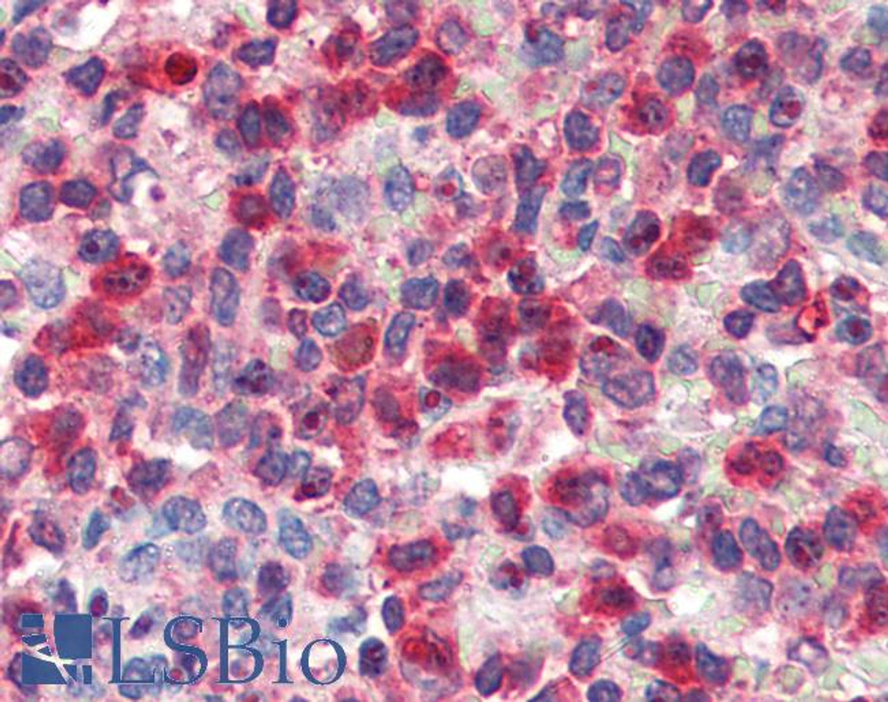 45-644 (5ug/ml) as the reporter antibody.