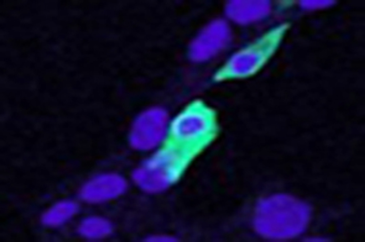 45-645 (0.5ug/ml) staining of K562 cell lysate (35ug protein in RIPA buffer) . Primary incubation was 1 hour. Detected by chemiluminescence.