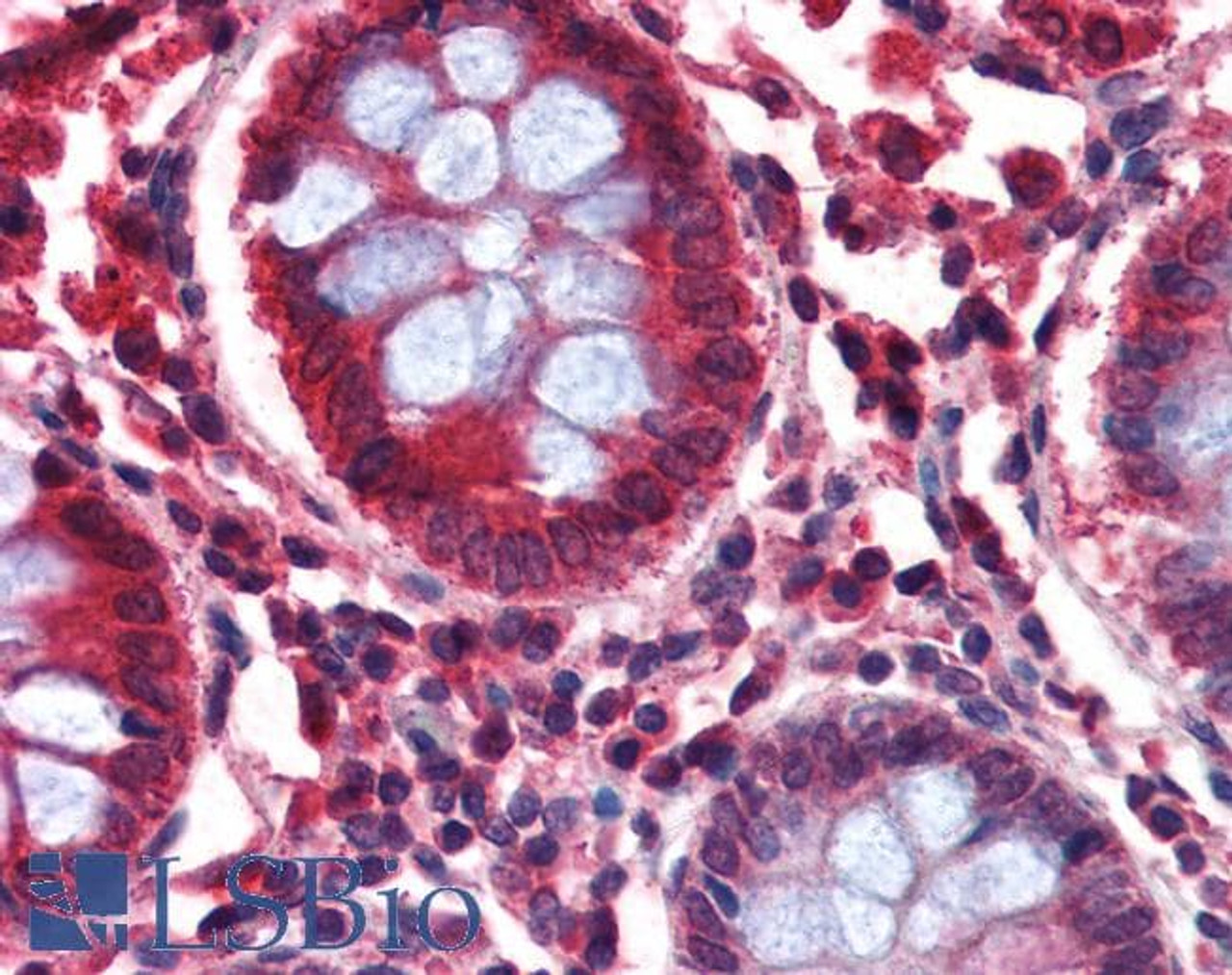 45-648 (0.5ug/ml) staining of Human Brain (Hippocampus) lysate (35ug protein in RIPA buffer) . Detected by chemiluminescence.