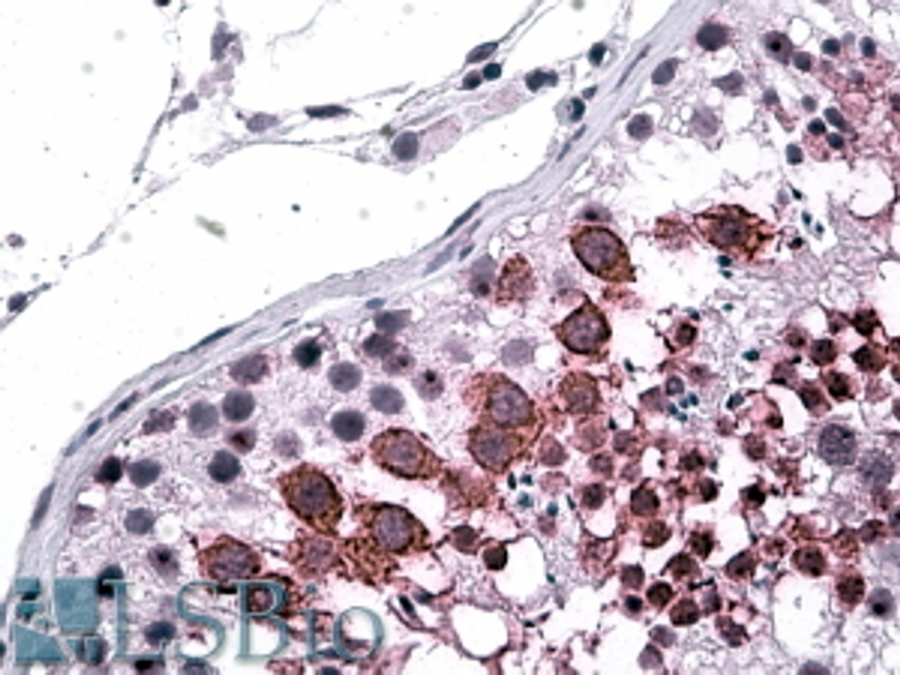 45-650 (2ug/ml) staining of Human Skin lysate (35ug protein in RIPA buffer) . Primary incubation was 1 hour. Detected by chemiluminescence.