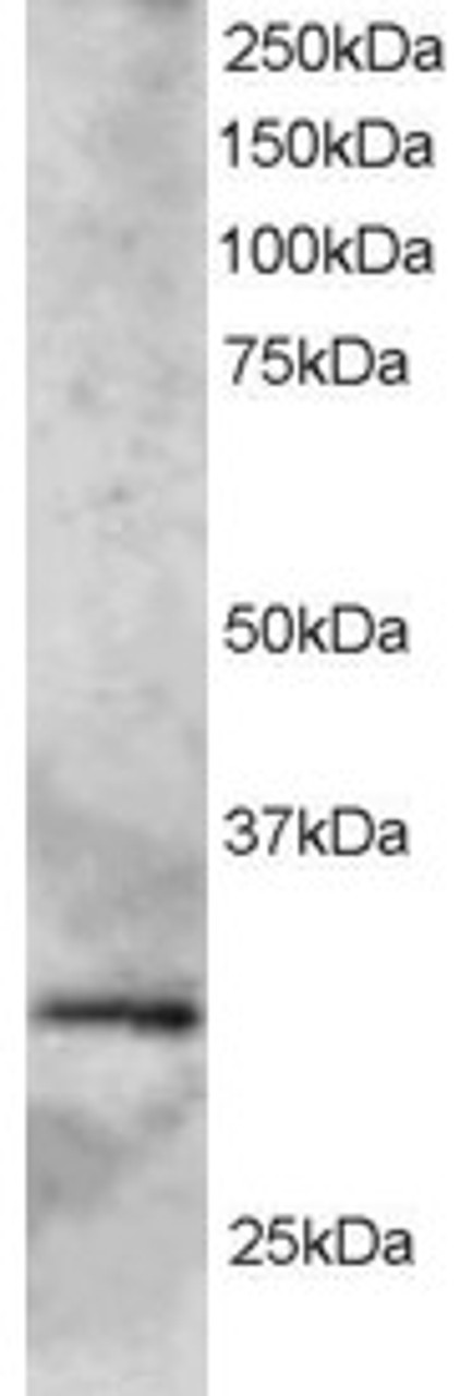 45-661 staining (2ug/ml) of Human Heart lysate (RIPA buffer, 35ug total protein per lane) . Primary incubated for 1 hour. Detected by western blot using chemiluminescence.