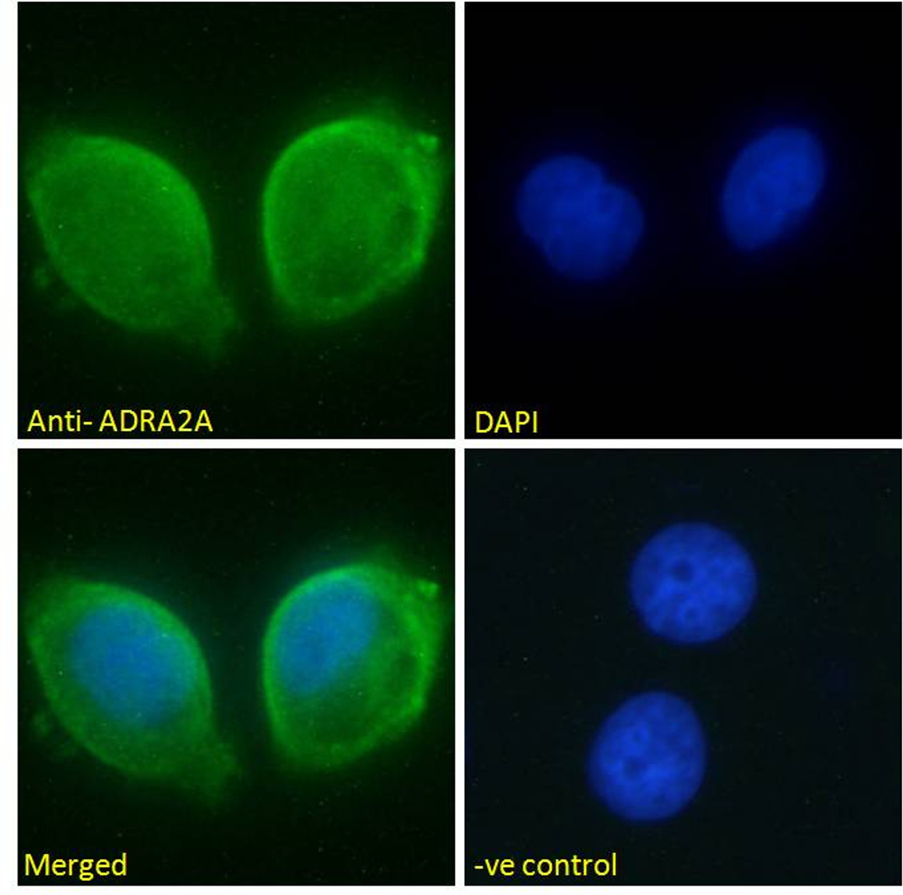 45-674 Negative Control showing staining of paraffin embedded Human Lymph Node, with no primary antibody.