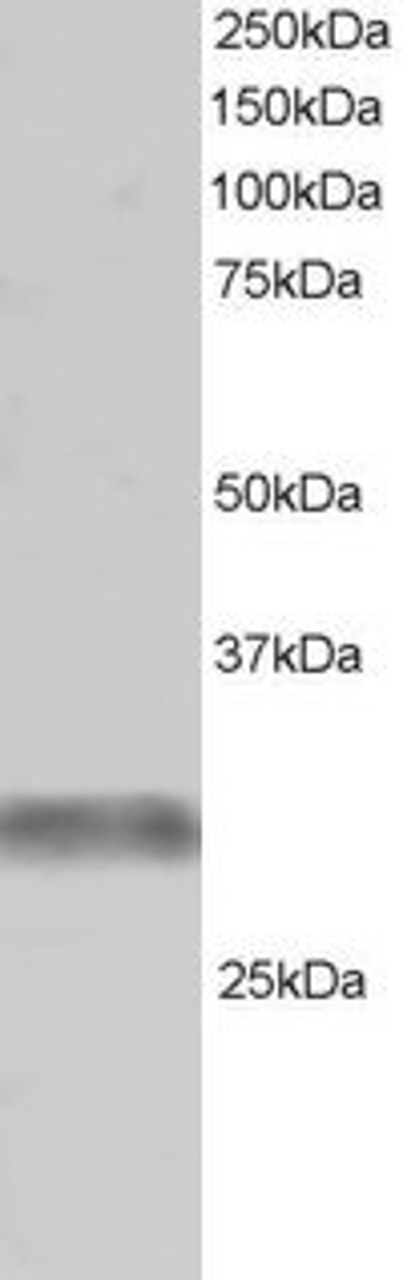 45-684 (1ug/ml) staining of Human Skeletal Muscle lysate (RIPA buffer, 30ug total protein per lane) . Primary incubated for 1 hour. Detected by western blot using chemiluminescence.