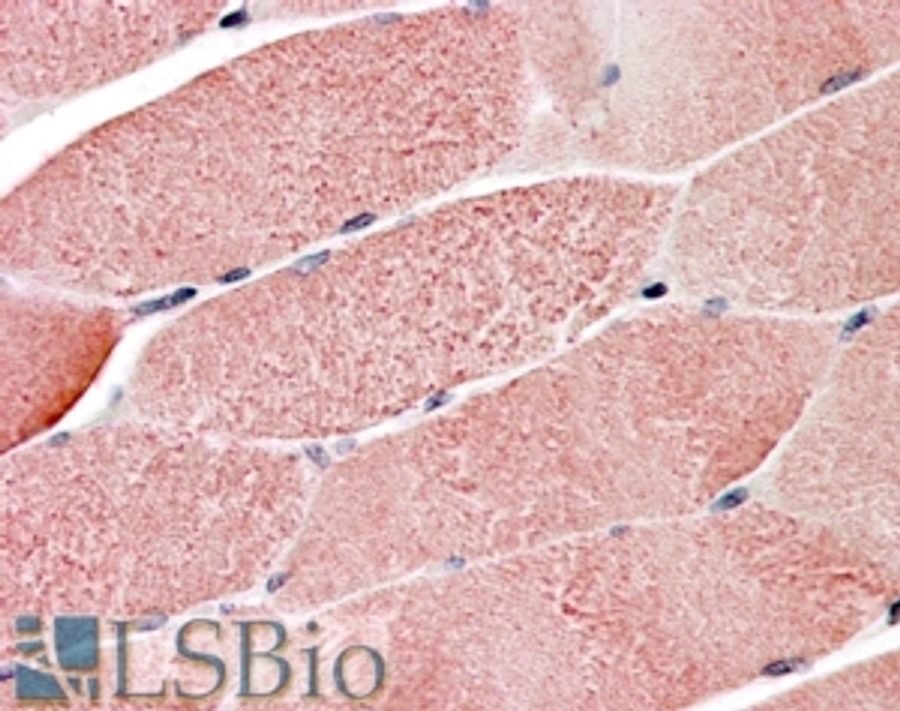 45-684 (3.8ug/ml) staining of paraffin embedded Human Skeletal Muscle. Steamed antigen retrieval with citrate buffer pH 6, AP-staining.