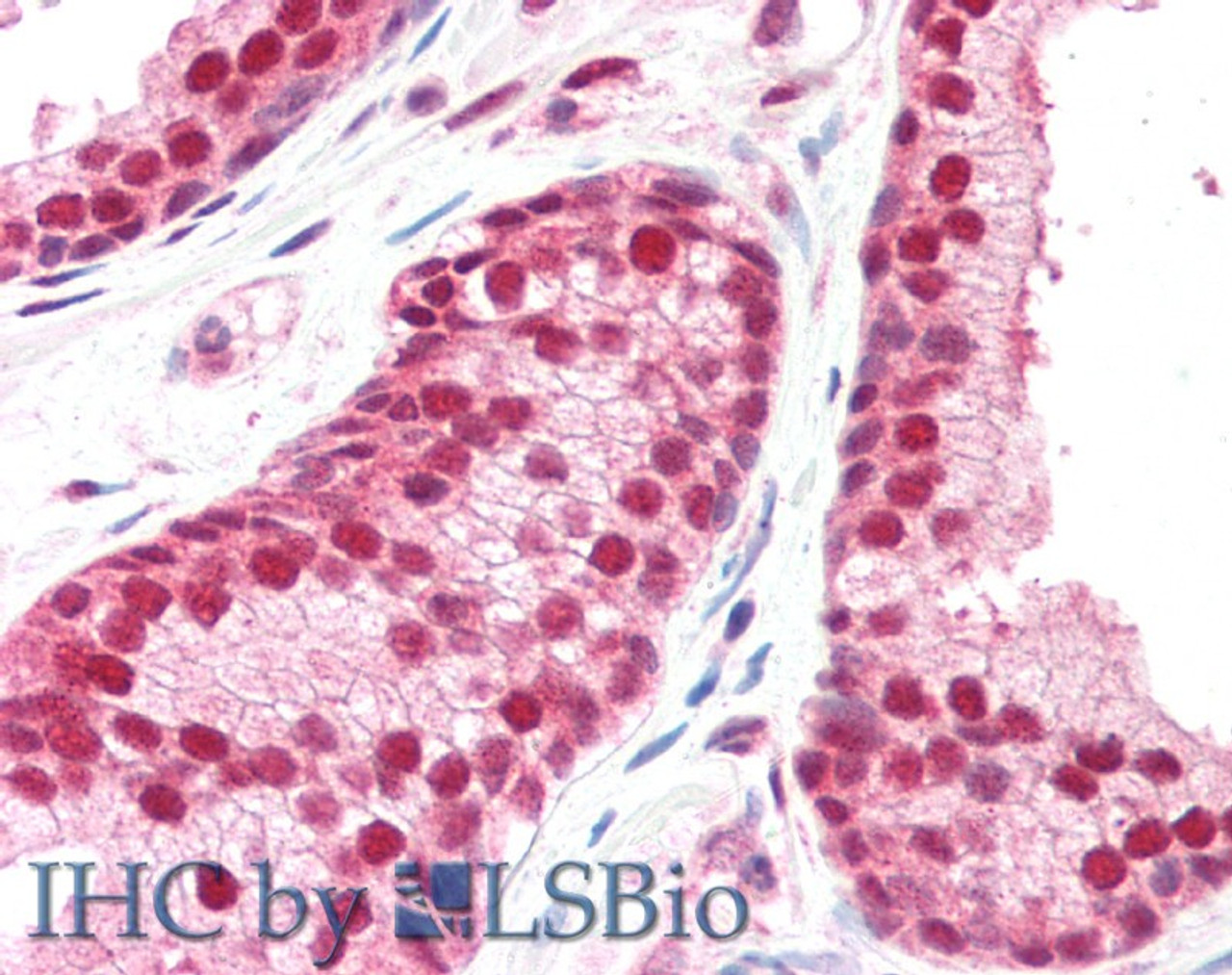 45-697 (5ug/ml) staining of paraffin embedded Human Prostate. Steamed antigen retrieval with citrate buffer pH 6, AP-staining.