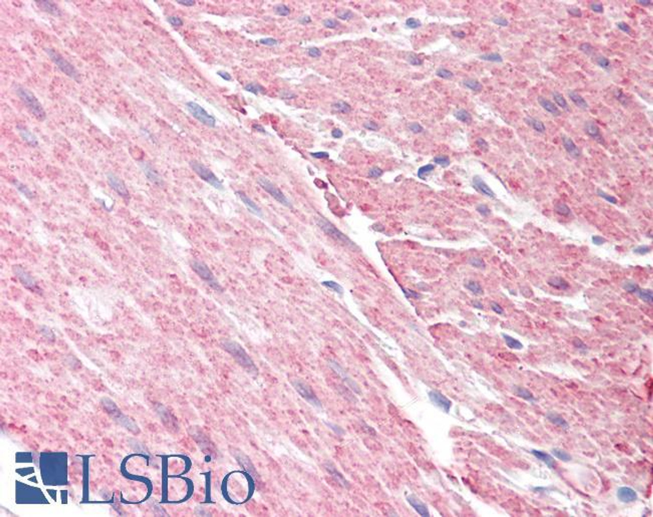 45-703 (3.75ug/ml) staining of paraffin embedded Human Colon. Steamed antigen retrieval with citrate buffer pH 6, AP-staining.