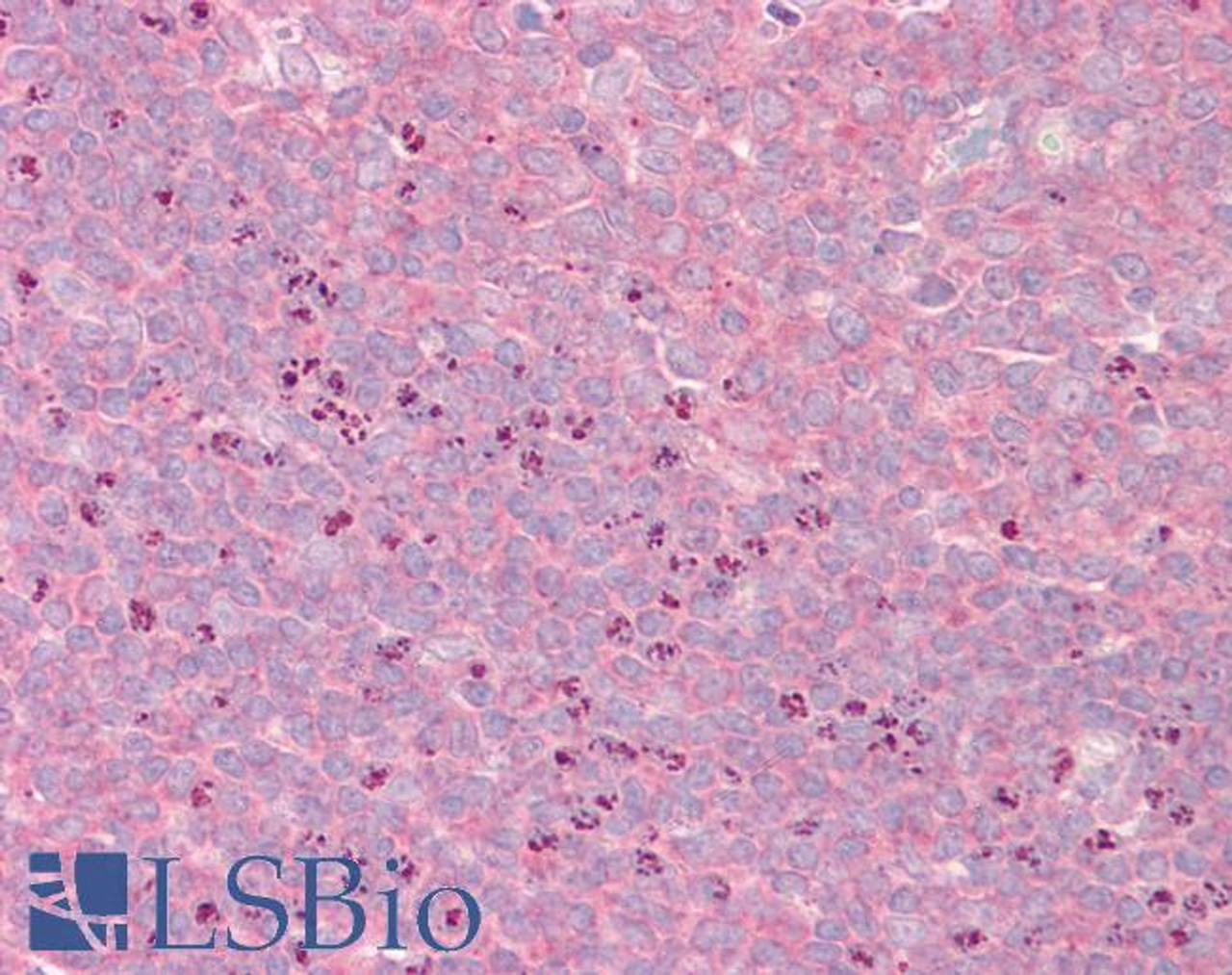 45-706 (3.75ug/ml) staining of paraffin embedded Human Tonsil. Steamed antigen retrieval with citrate buffer pH 6, AP-staining.