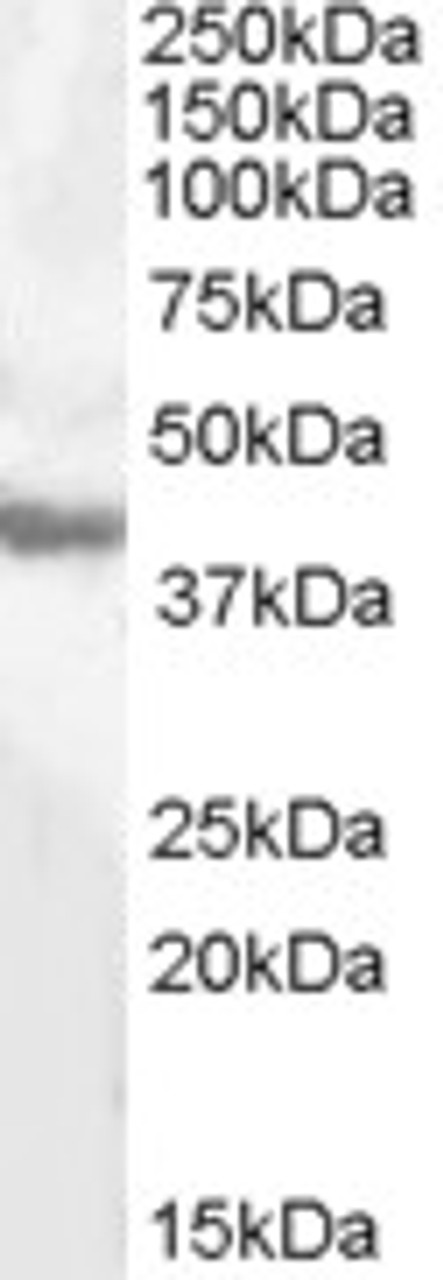 HEK293 overexpressing HADH with C-terminal tag (DYKDDDDK) and probed with anti-DYKDDDDK in the left panel and with 45-717 in the right panel (mock transfection in first and last lanes) .