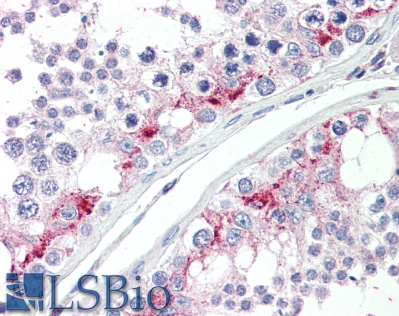 45-728 (1ug/ml) staining of Mouse Brain lysate (35ug protein in RIPA buffer) . Primary incubation was 1 hour. Detected by chemiluminescence.