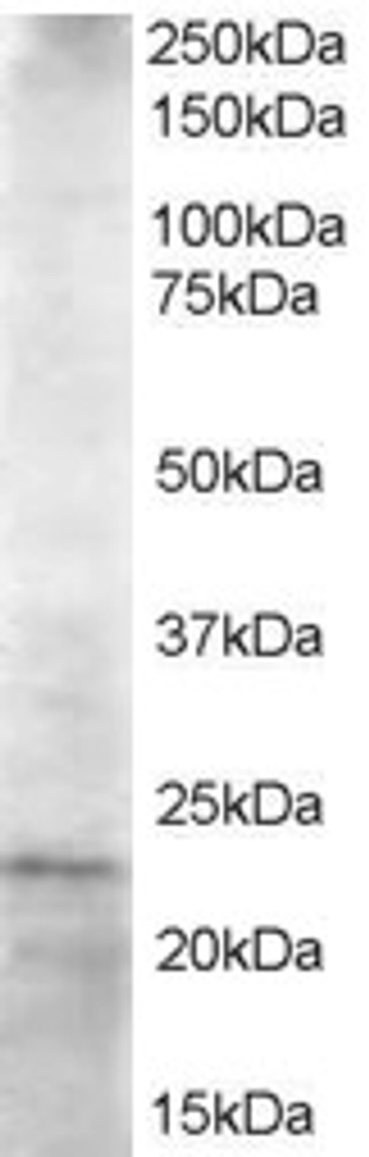 45-729 staining (1.5ug/ml) of Jurkat lysate (RIPA buffer, 35ug total protein per lane) . Primary incubated for 1 hour. Detected by western blot using chemiluminescence.