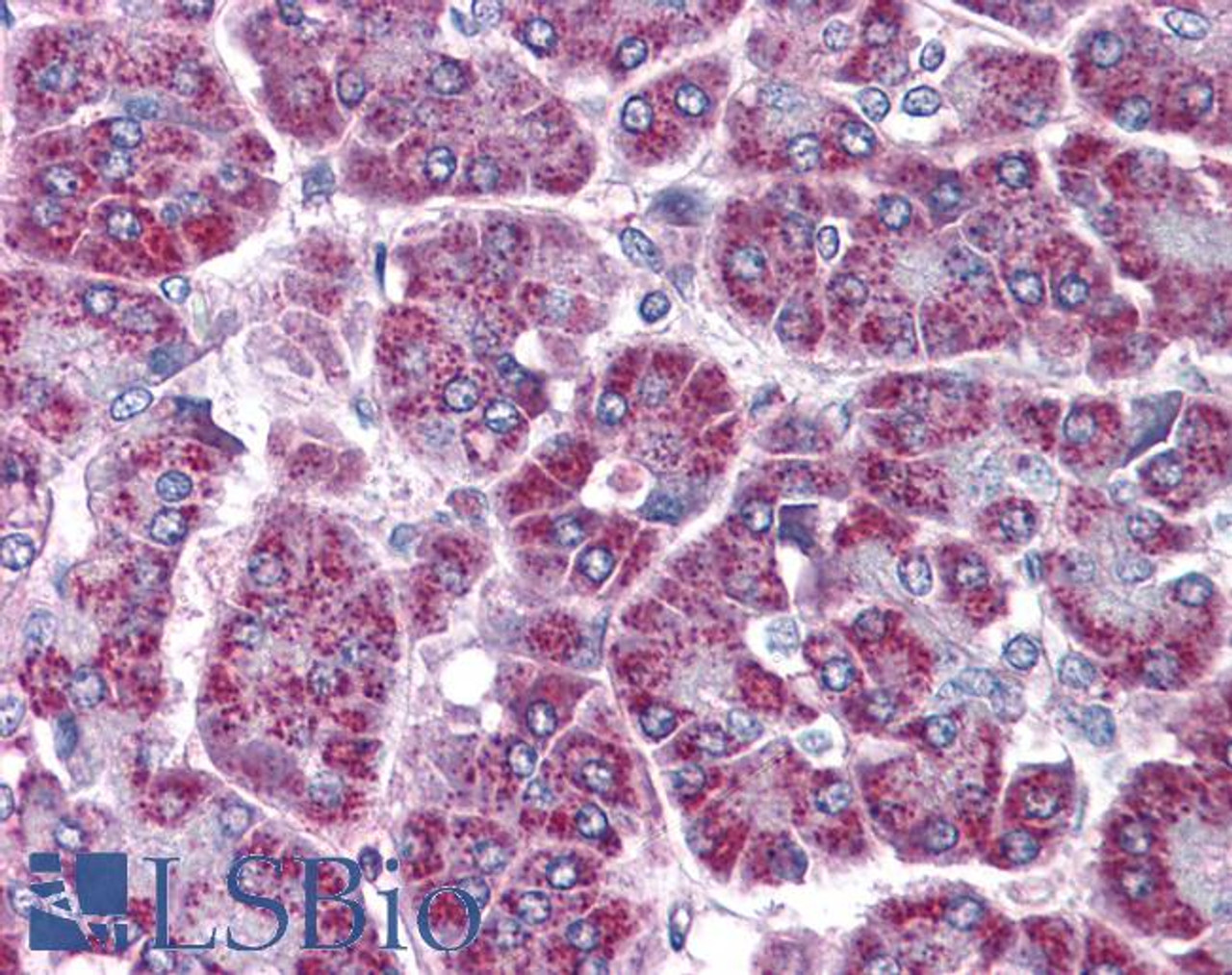 45-732 (4ug/ml) staining of paraffin embedded Human Lung. Microwaved antigen retrieval with citrate buffer pH 6, HRP-staining.