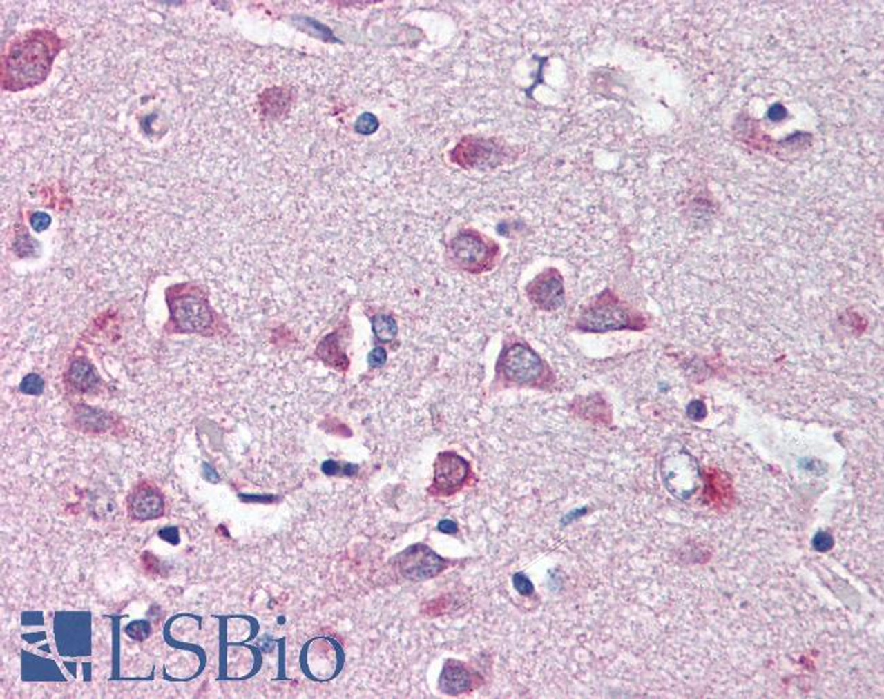 45-752 (1ug/ml) staining of Daudi cell lysate (35ug protein in RIPA buffer) . Primary incubation was 1 hour. Detected by chemiluminescence.