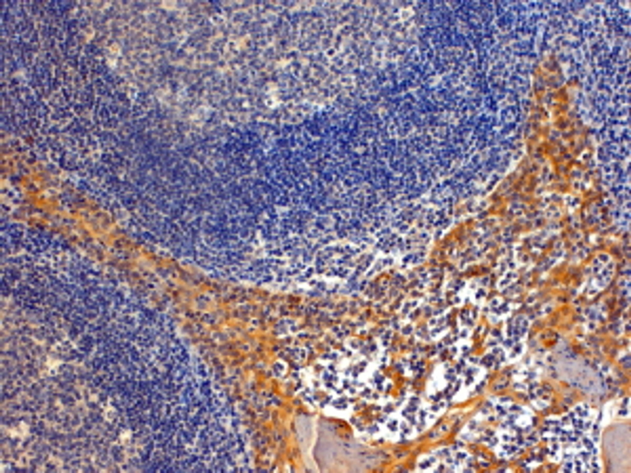 45-771 (4ug/ml) staining of paraffin embedded Human Tonsil. Steamed antigen retrieval with Tris/EDTA buffer pH 9, HRP-staining. Similar results were obtained after antigen retrieval at pH9.