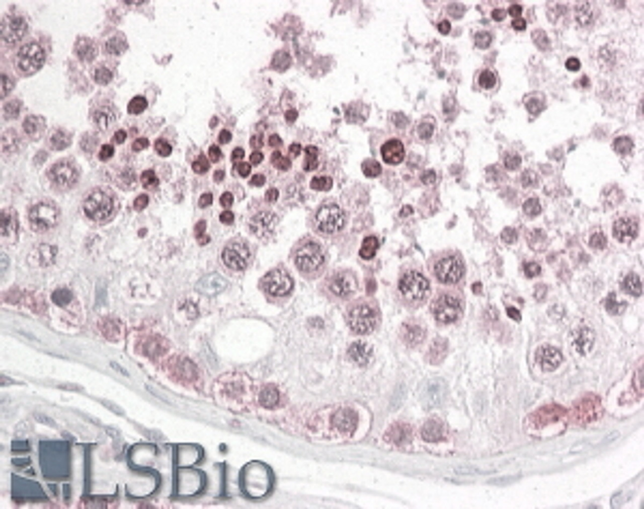 45-772 (3.8ug/ml) staining of paraffin embedded Human Testis. Steamed antigen retrieval with citrate buffer pH 6, AP-staining. <strong>This data is from a previous batch, not on sale.</strong>
