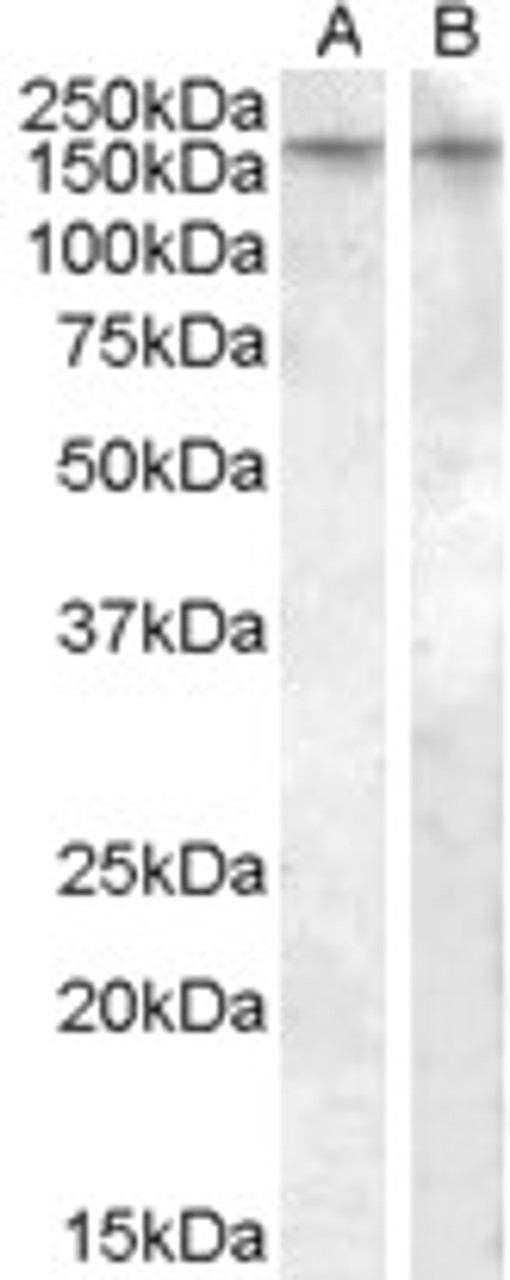 45-778 (0.05μg/ml) staining of Rat Liver lysate (35μg protein in RIPA buffer) . Primary incubation was 1 hour. Detected with chemiluminescence.