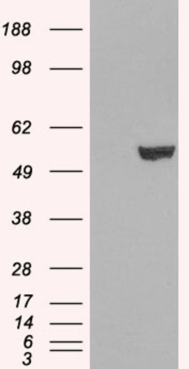 HEK293 overexpressing IRF6 and probed with 45-781 (mock transfection in first lane) .