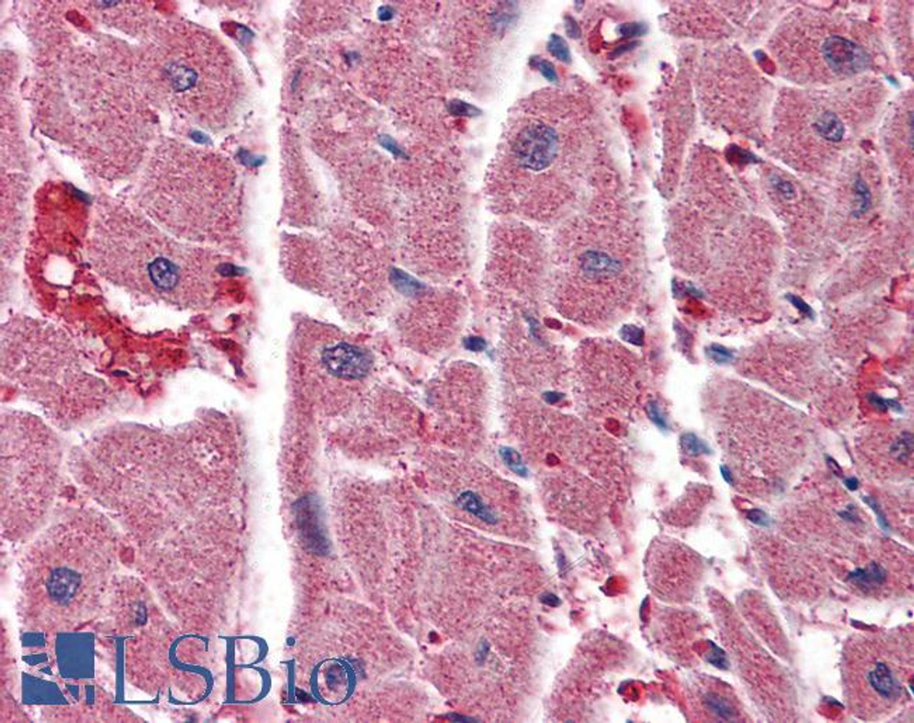 45-785 (3.75ug/ml) staining of paraffin embedded Human Skin. Steamed antigen retrieval with citrate buffer pH 6, AP-staining.