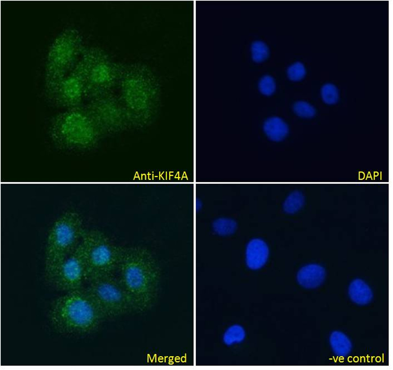 45-798 Immunofluorescence analysis of paraformaldehyde fixed U2OS cells, permeabilized with 0.15% Triton. Primary incubation 1hr (10ug/ml) followed by Alexa Fluor 488 secondary antibody (4ug/ml) , showing nuclear staining. The nuclear stain is DAPI (blue)