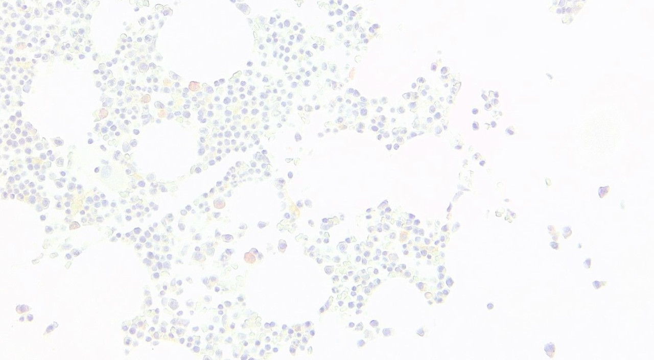 45-801 Negative Control showing staining of paraffin embedded Human Bone Marrow, with no primary antibody.