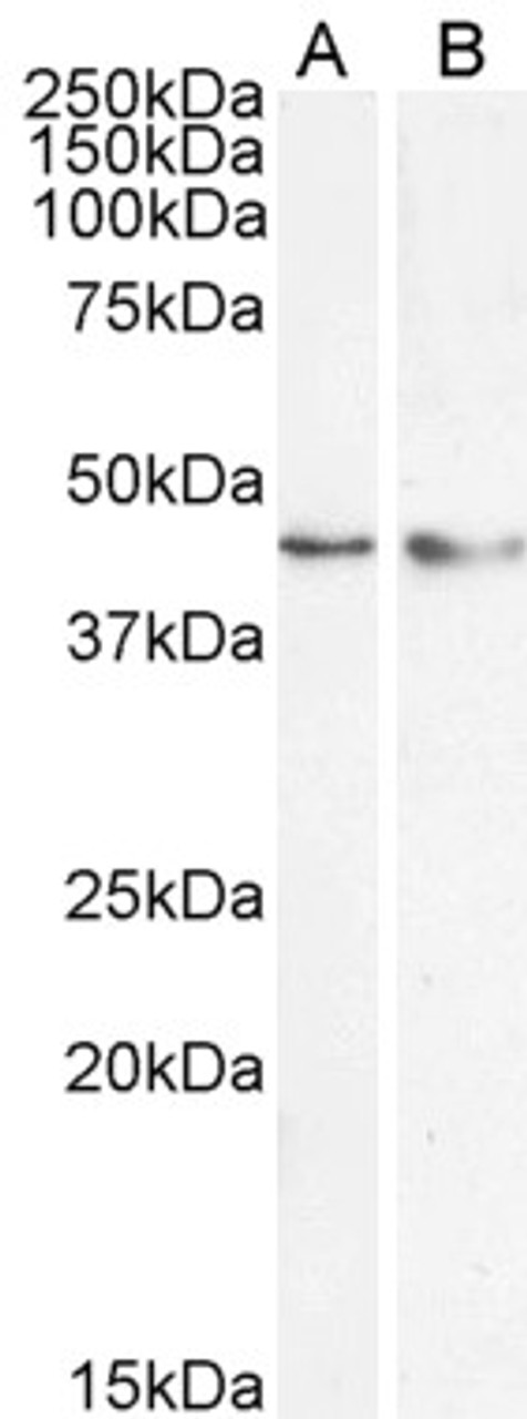 45-803 (1ug/ml) staining of nuclear HepG2 (A) and (0.5ug/ml) HeLa (B) cell lysate (35ug protein in RIPA buffer) . Detected by chemiluminescence.
