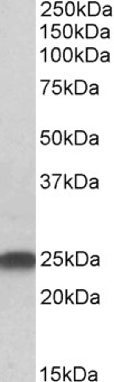 45-832 (0.5ug/ml) staining of Rat Brain lysate (35ug protein in RIPA buffer) . Primary incubation was 1 hour. Detected by chemiluminescence.