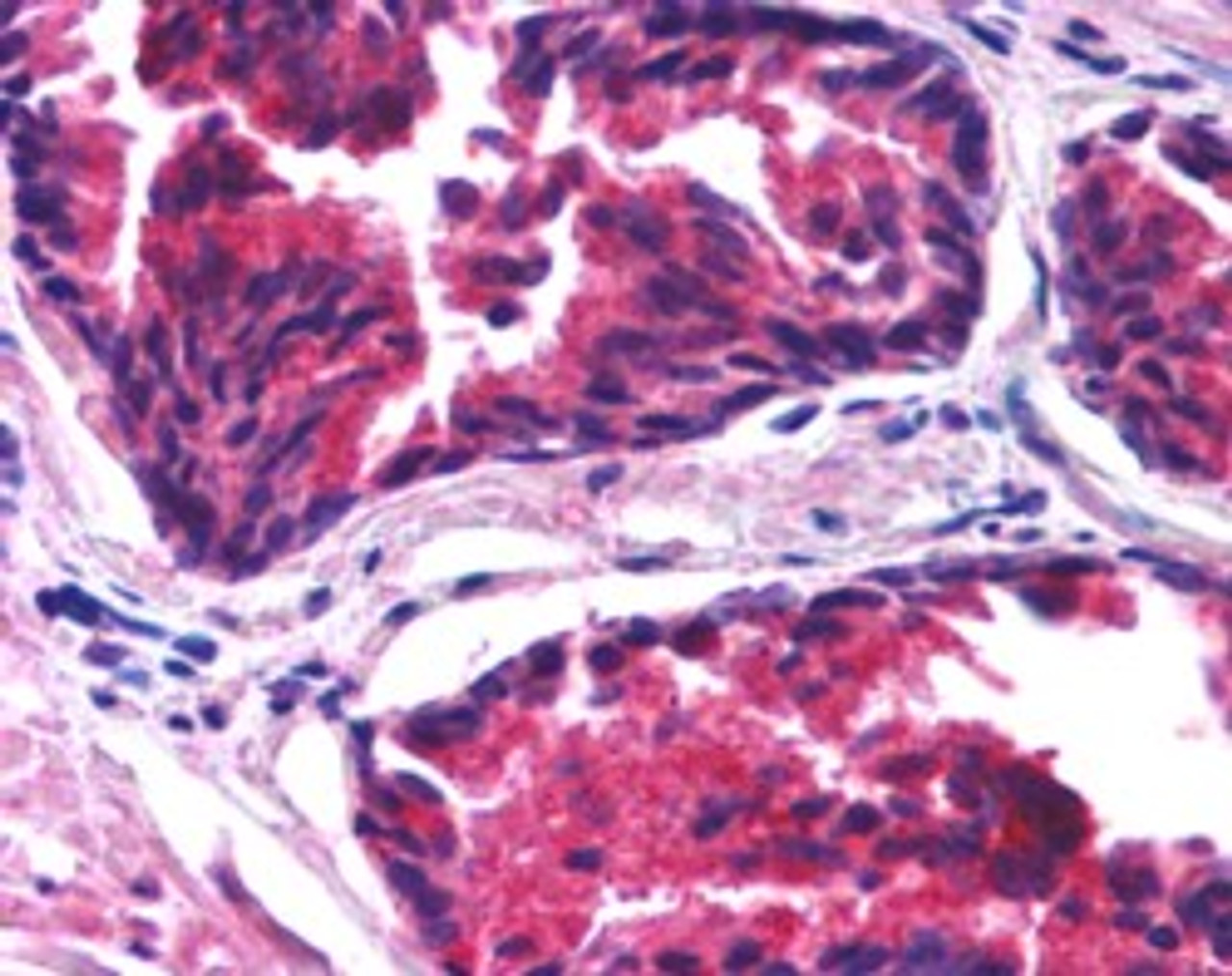 45-837 (2.5ug/ml) staining of paraffin embedded Human Thyroid Gland. Steamed antigen retrieval with citrate buffer pH 6, AP-staining.