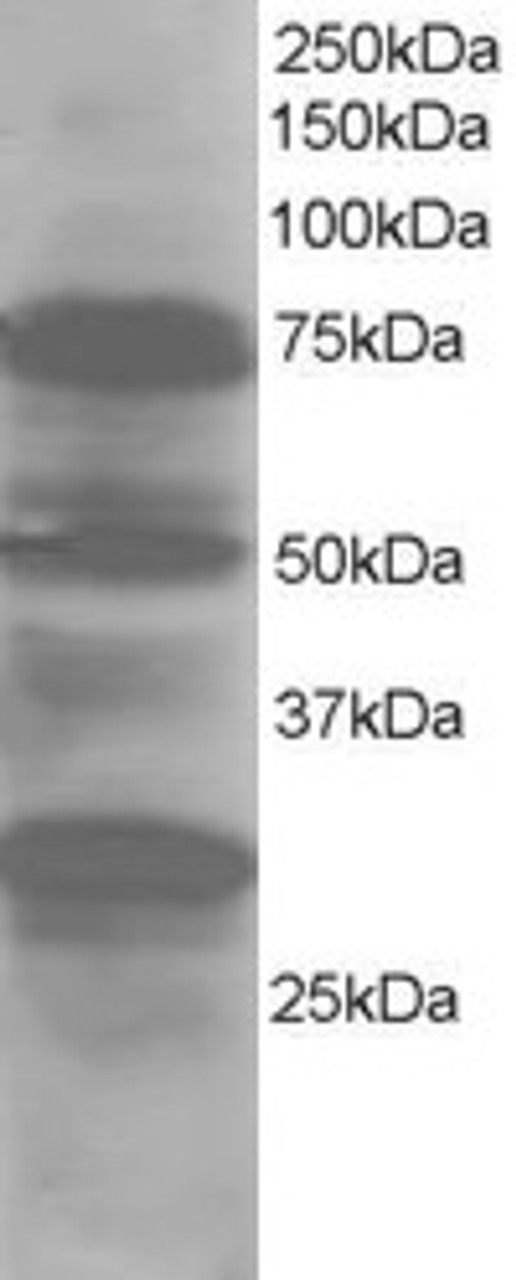45-843 staining (1ug/ml) of Human Lung lysate (RIPA buffer, 30ug total protein per lane) . Primary incubated for 1 hour. Detected by western blot using chemiluminescence.
