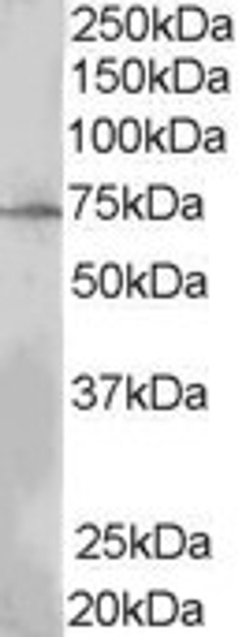 45-844 (0.3ug/ml) staining of MOLT4 lysate (35ug protein in RIPA buffer) . Primary incubation was 1 hour. Detected by chemiluminescence.