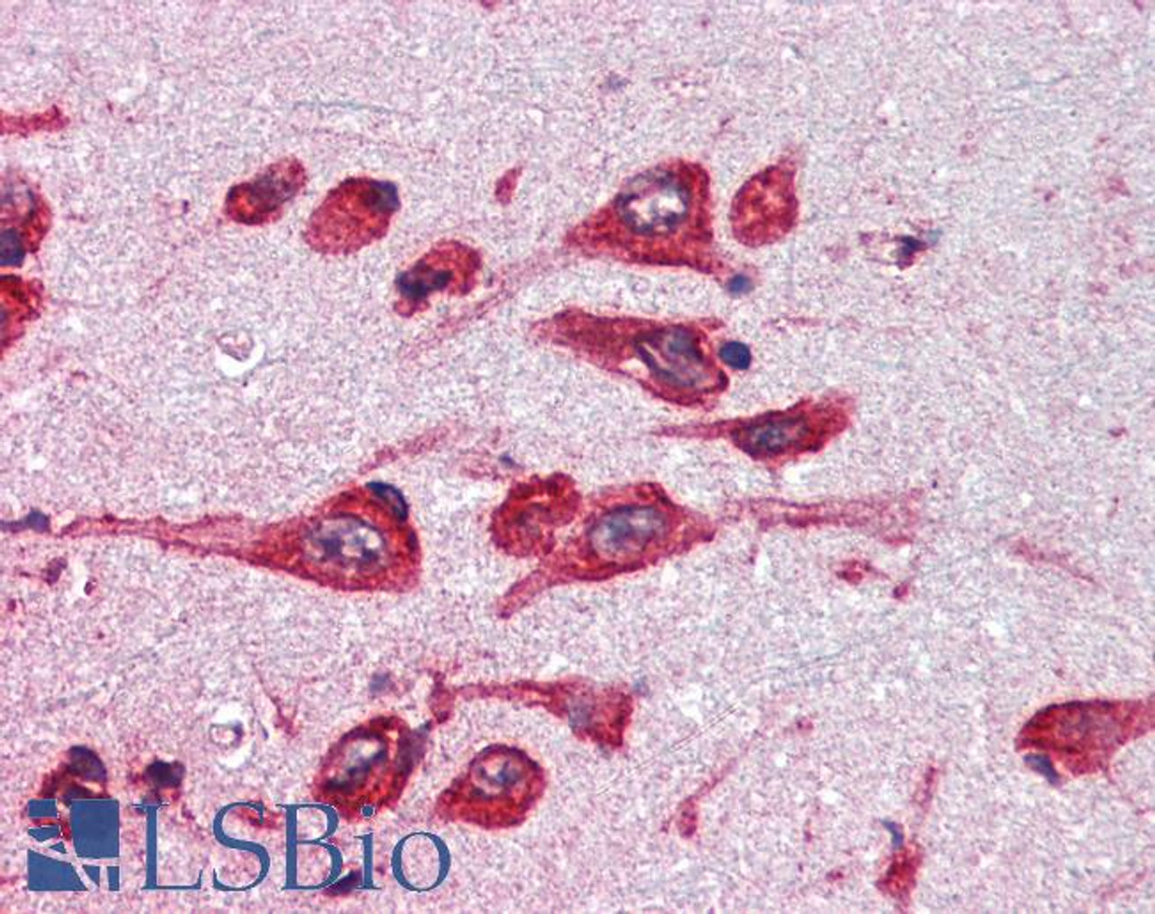 45-862 (0.5ug/ml) as the reporter antibody.