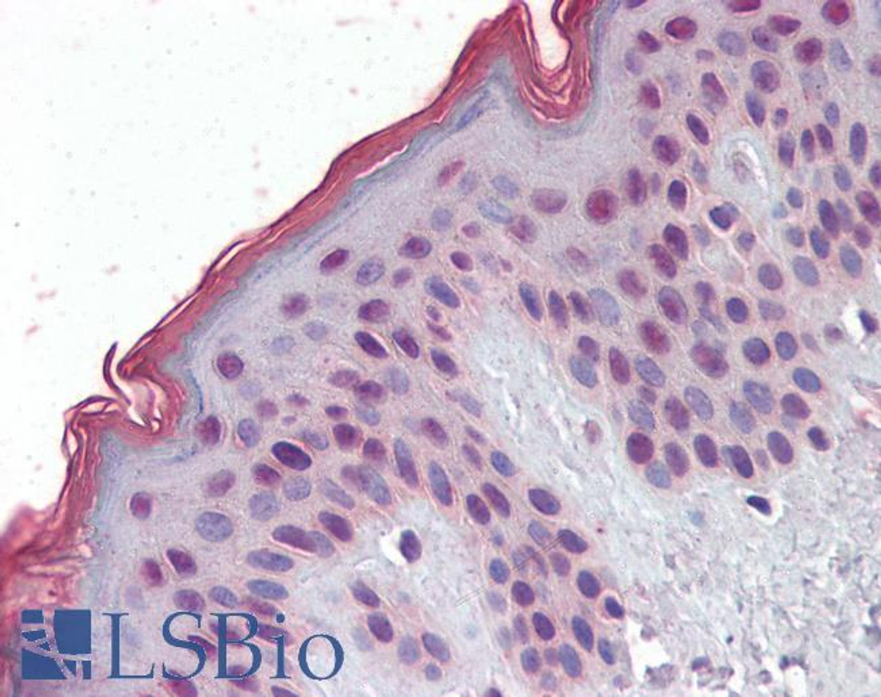 45-868 (2.5ug/ml) staining of paraffin embedded Human Colon. Steamed antigen retrieval with citrate buffer pH 6, AP-staining.